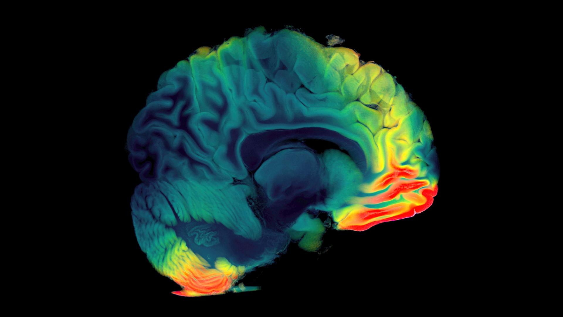 3D visualization of the digital study of the human brain using MTC and MRI